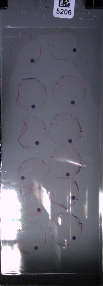 Media type: image; Special Collections 4011   shows specimen_part histological serial section;